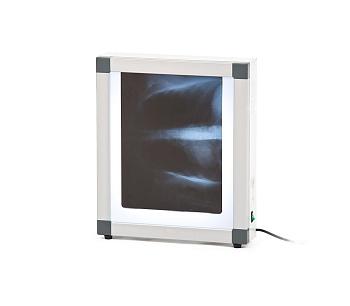 Негатоскоп